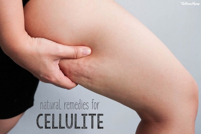 cellulite the natural cure book reviews
