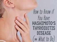 How to Know if You Have Hashimoto's Disease and What to Do