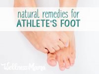 Natural remedies for athletes foot